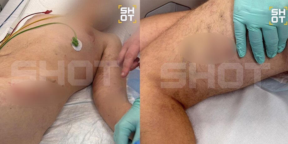    Фото: телеграм-канал SHOT