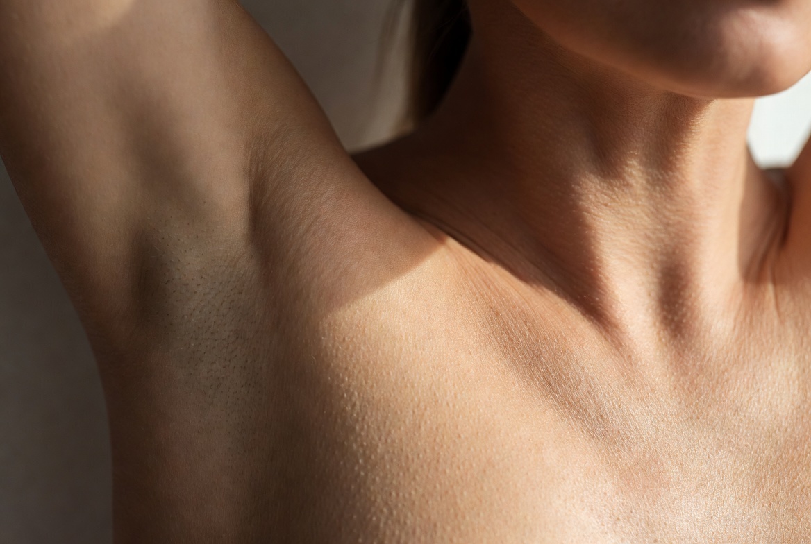 Почему темнеют подмышки и как их быстро осветлить: методы, которые работают Анастасия Никандрова📷
