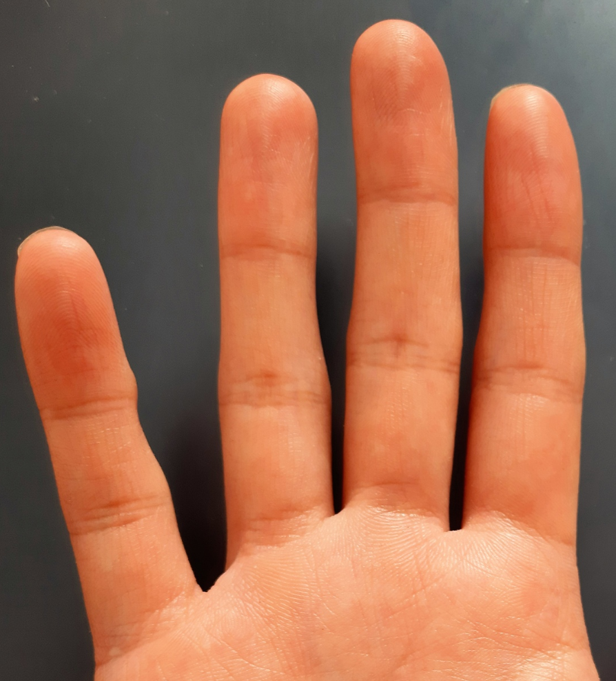 Пример короткого среднего пальца