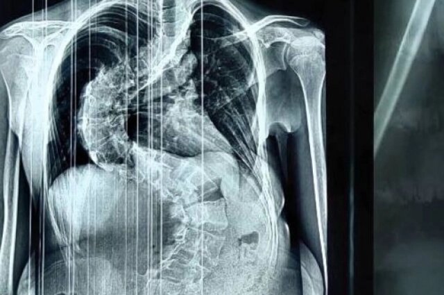    Фото: Министерство здравоохранения Кировской области