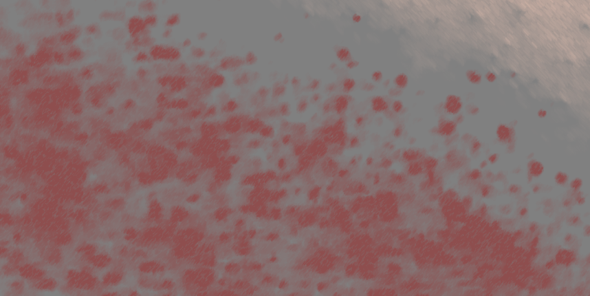    Акне ниже шеи: как избавиться от воспалений на теле? Отвечает эксперт (фото 2)