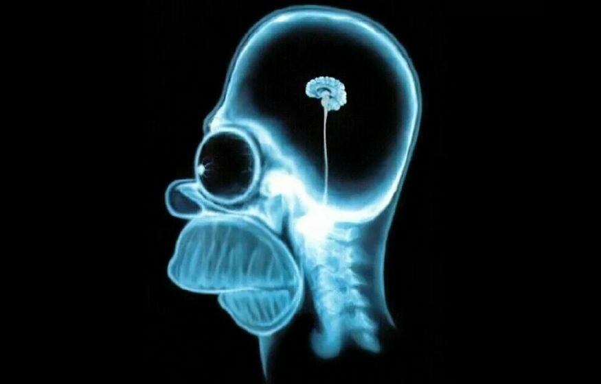    Массовое слабоумие из-за лишнего веса — новая угроза человечеству