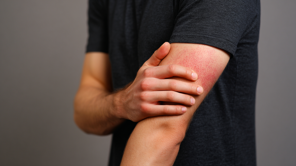 Вспышку викторианской болезни зафиксировали в Великобритании