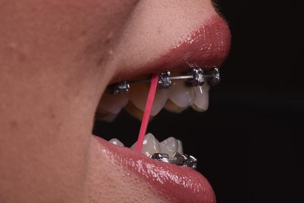 Выбрать яркие эластики любимого цвета — а почему бы и нет?