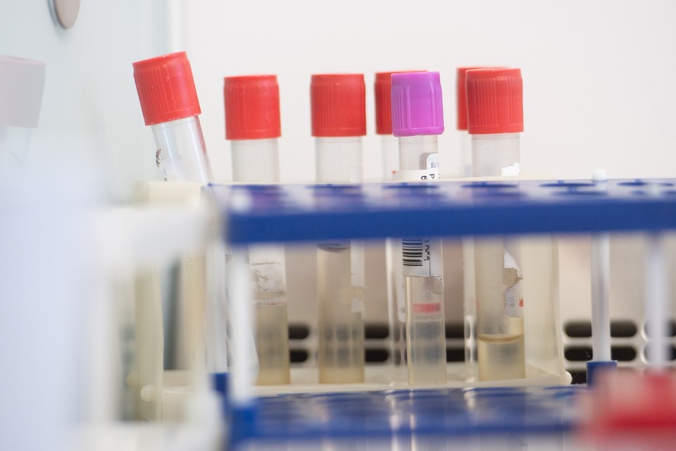    Ученые Петербурга продолжают искать лекарства от рака. Алексей БУЛАТОВ