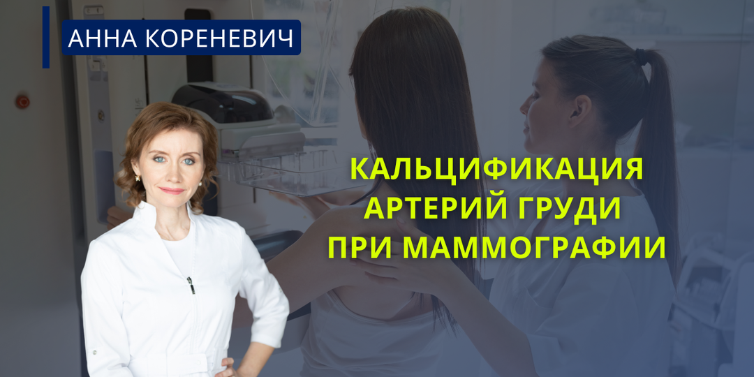 Кальцификация артерий груди при маммографии