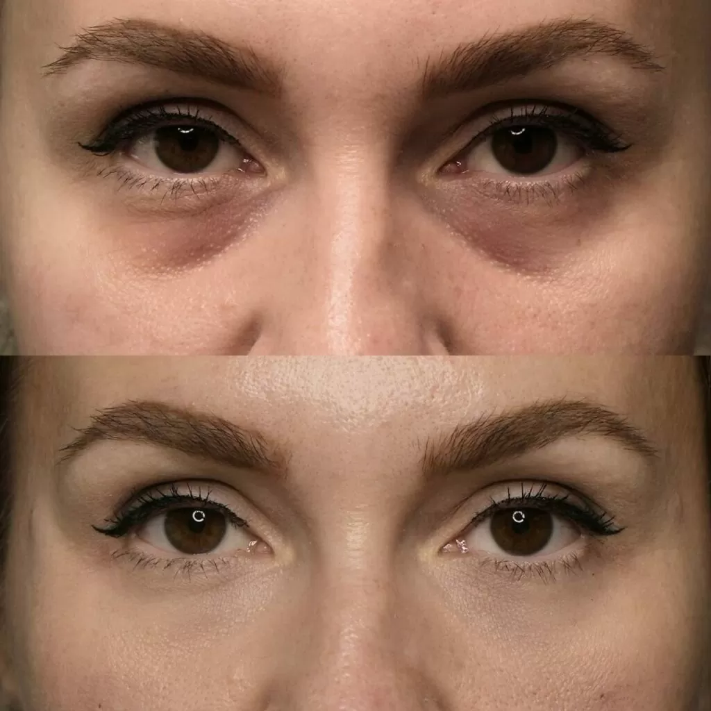 Реальные фото наших клиентов до и после процедуры