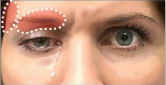 Кластерные головные боли – удел мужчин, хоть на картинке и девушка.