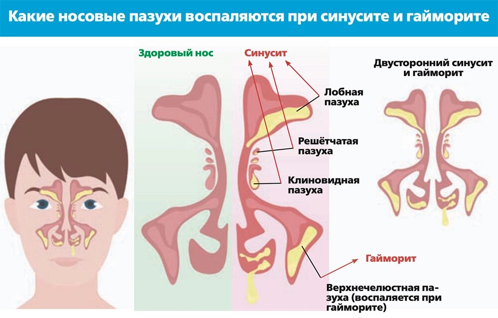    Нажмите для увеличения