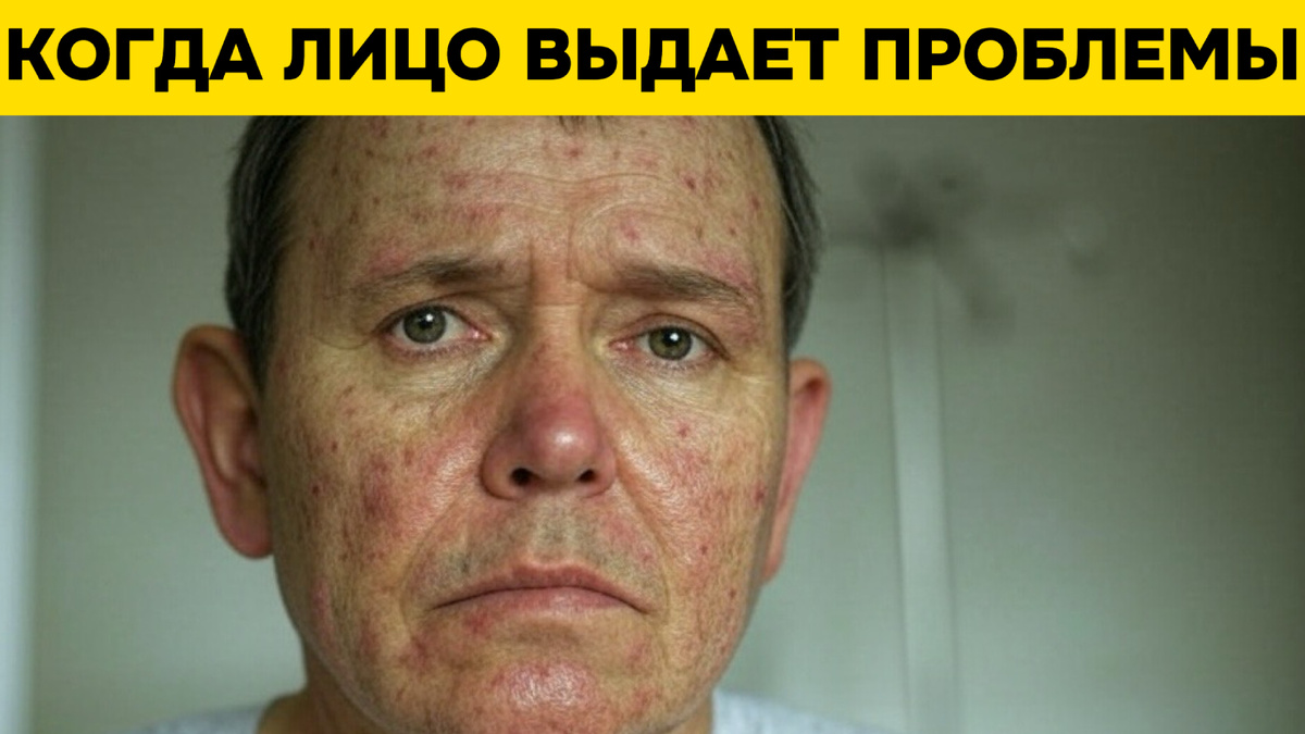 Появление асимметрии лица или непривычного цвета кожи