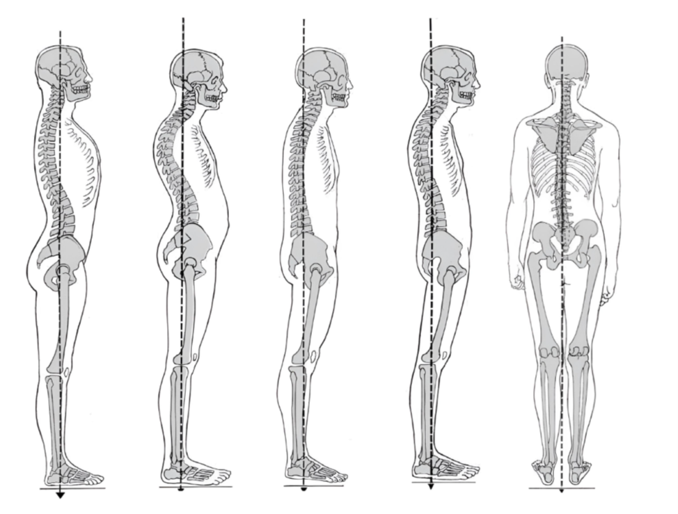 искривления