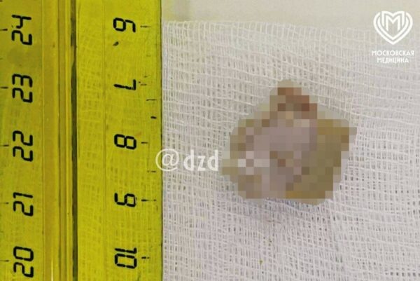    Фото:Telegram-канал «Московская медицина»