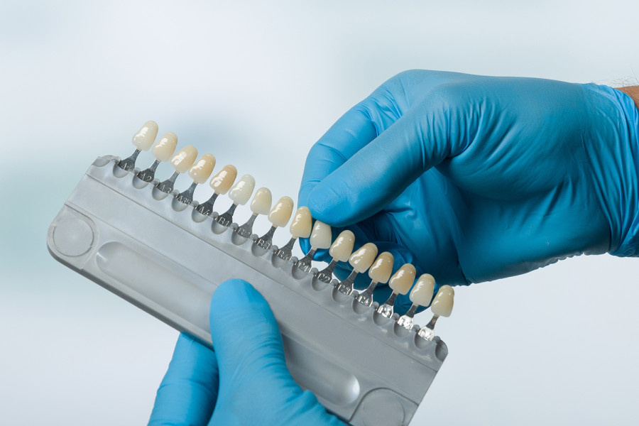 Оба типов виниров, керамические и композитные, отличаются по составу и процессу установки, но почти неотличимы по внешнему виду