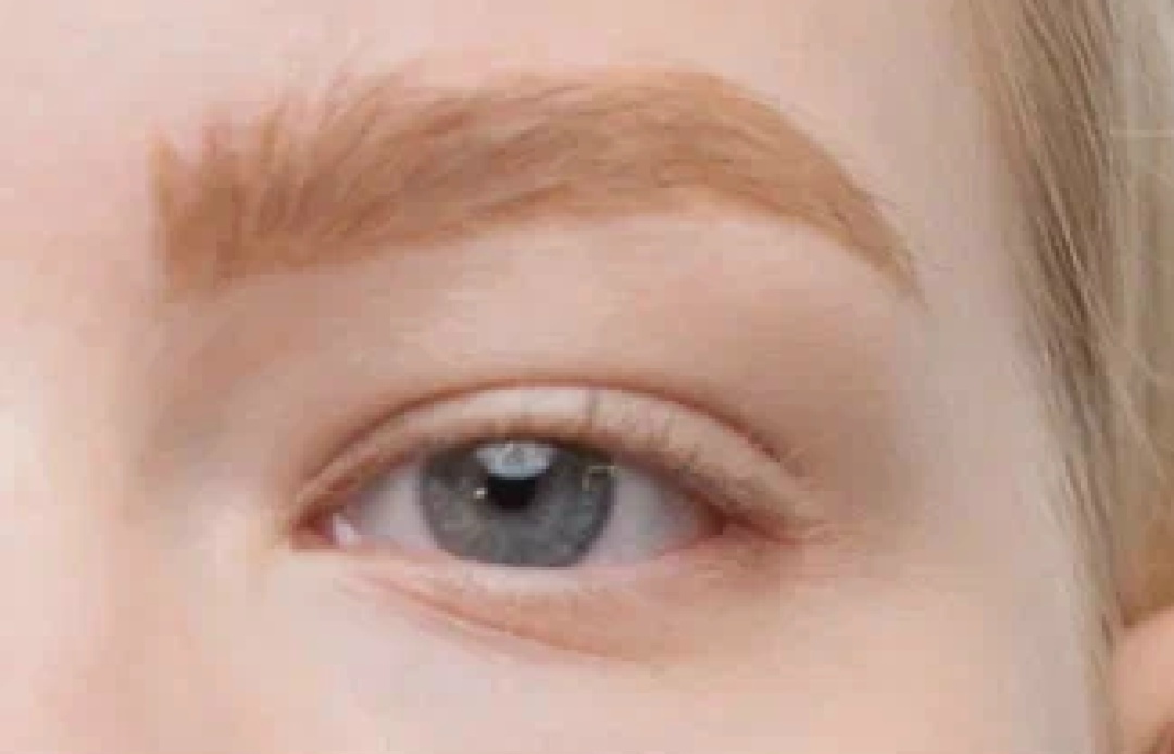 Волосковая техника