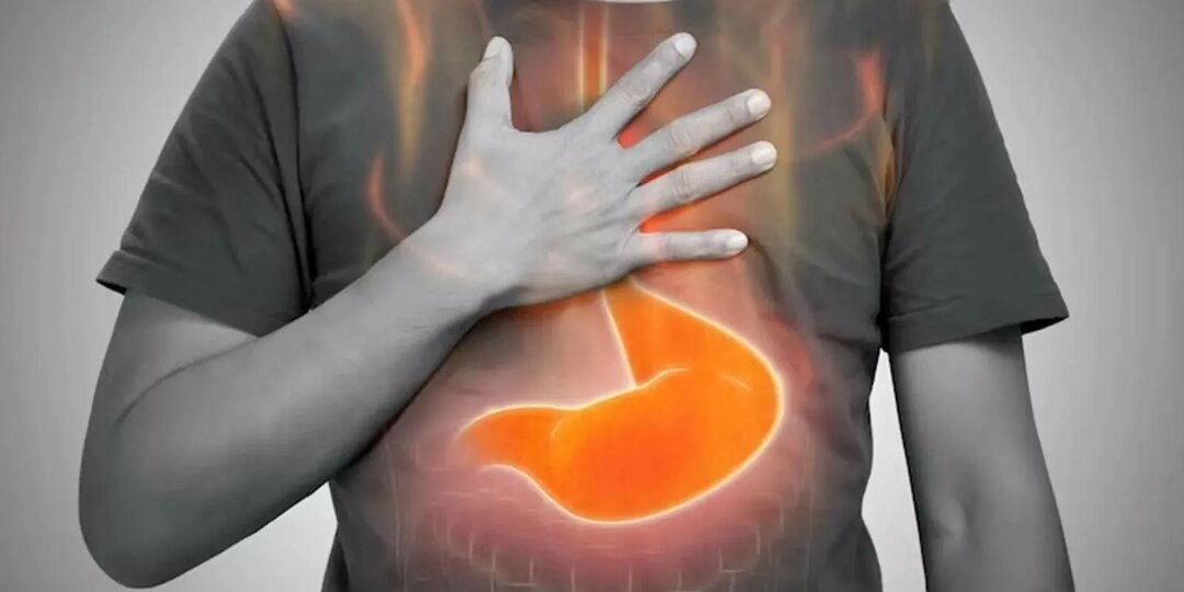 Как наладить питание при ГЭРБ — без стресса и жёстких ограничений