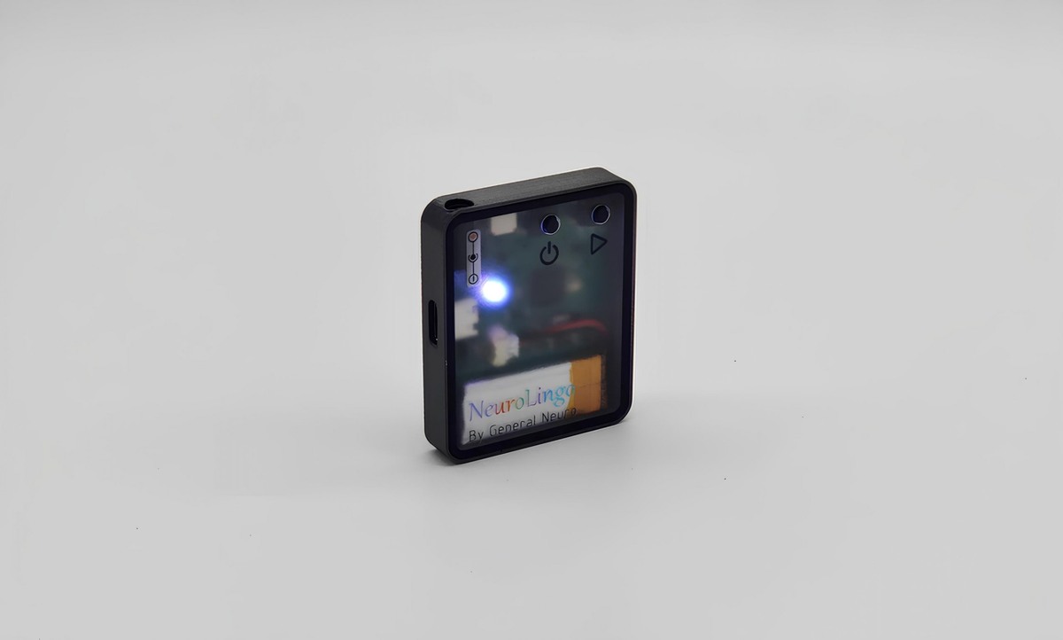 Фото: Generalneuro