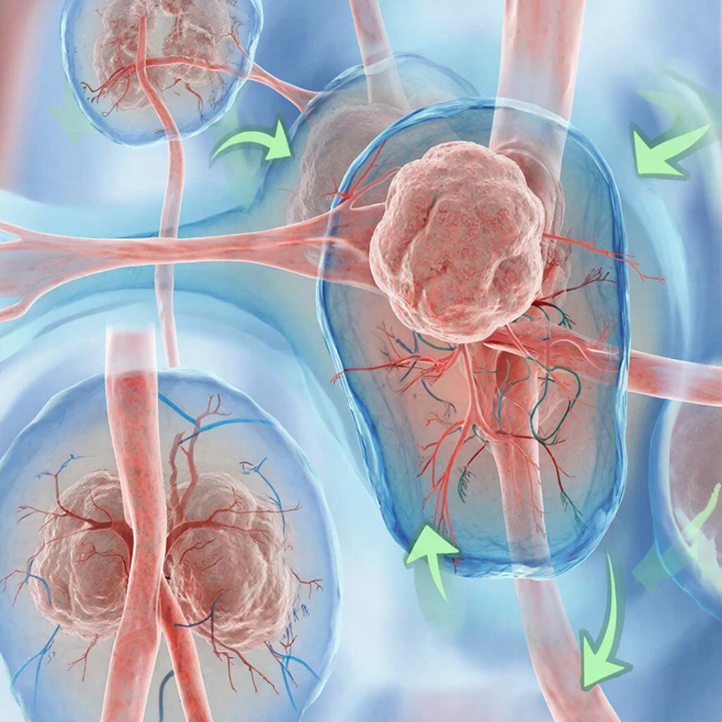 Лимфоузлы и ток лимфы