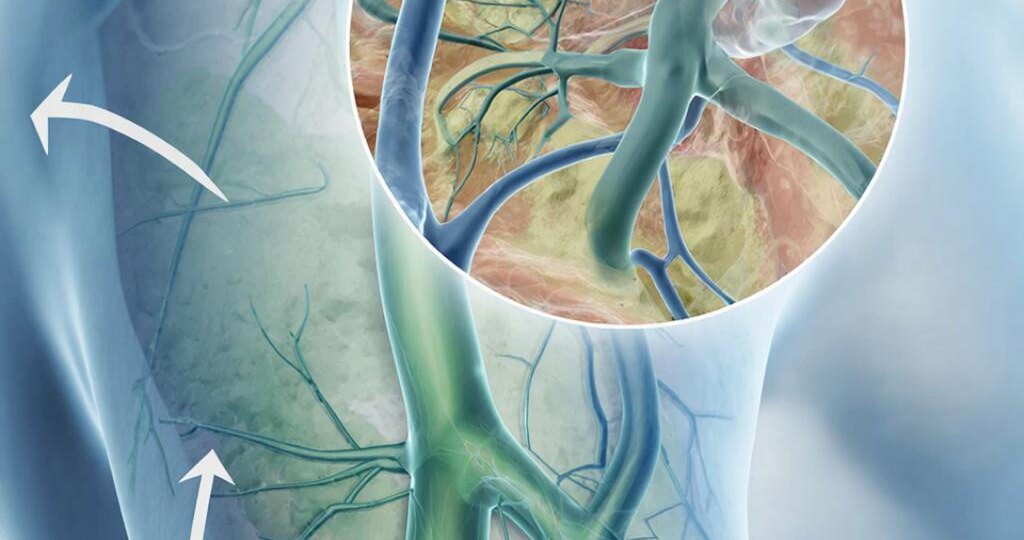 Лимфа: что это такое и как её «почистить» — проверенные и безопасные способы