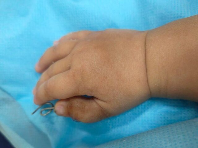    Фото: mz.mosreg.ru