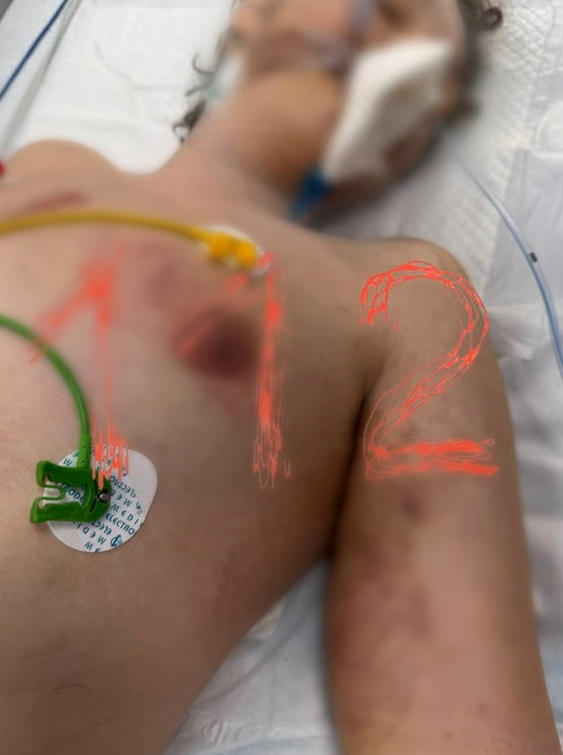 Роман со следами побоев на теле в больнице