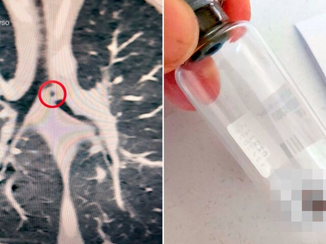    Фото: телеграм-канал "Здоровье уральцев"