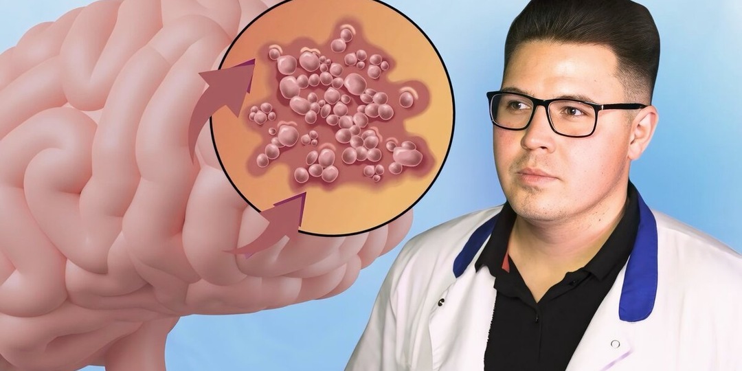 Герпес и Альцгеймер: в чём связь и как то, что вы считали безобидным, может ускорять старение мозга