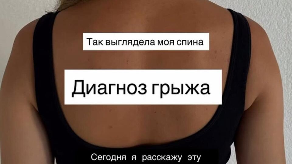 Моя история восстановления после диагноза “грыжа поясничного отдела”