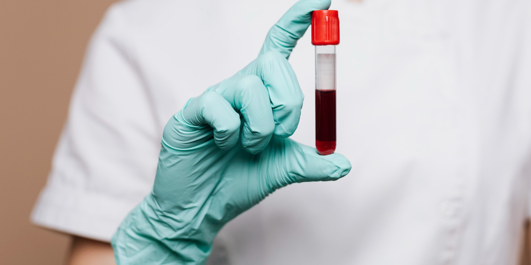 6 опасных загустителей крови, о которых вы не знали