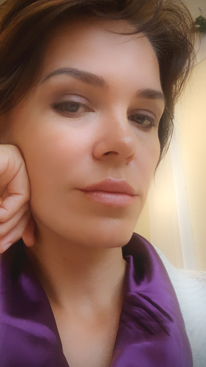 Круги под глазами теперь мое главное украшение😂 даже тональному их не скрывает