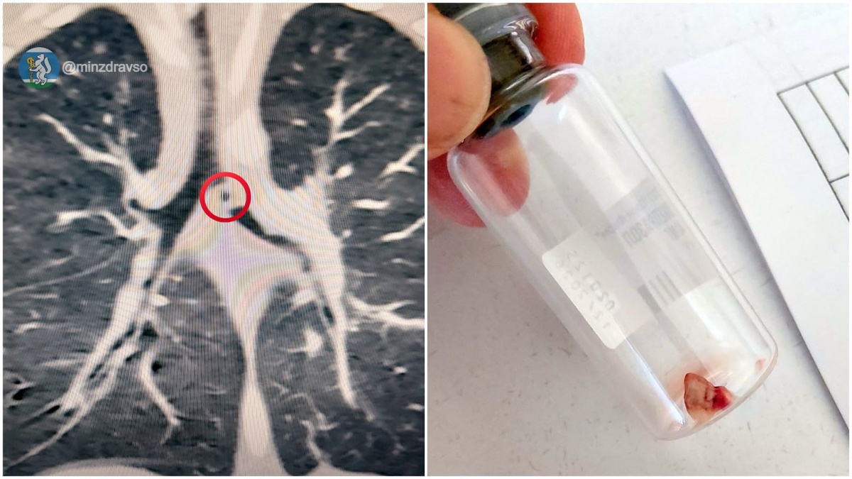 Фото: пресс-служба регионального Минздрава