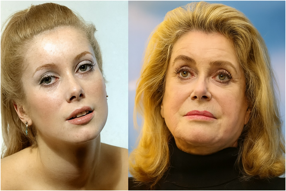 Деформационно-отечный тип старения требует особого подхода