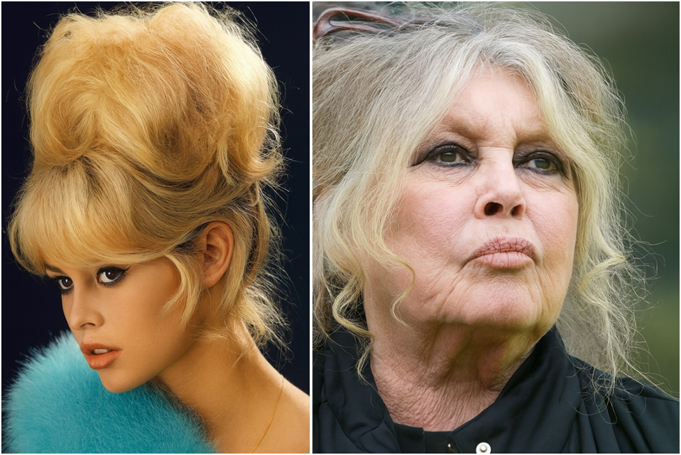 Резкие колебания массы тела растягивают кожу и усиливают отечность.