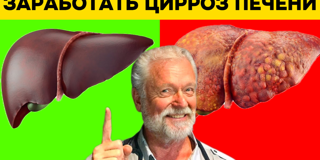 Гепатологи о циррозе: алкоголь — лишь одна из пяти ключевых причин
