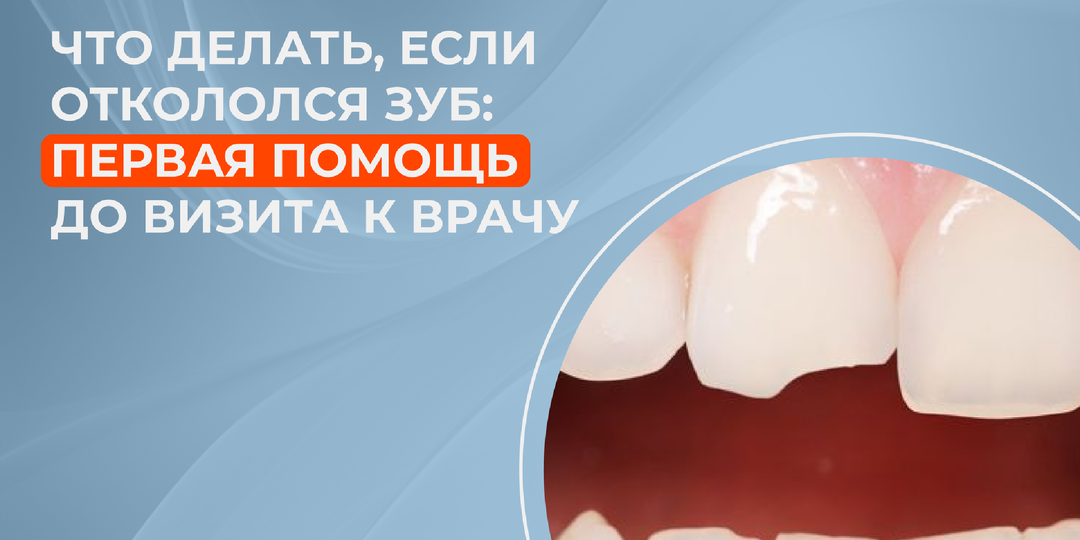 Что делать, если откололся зуб: первая помощь до визита к врачу