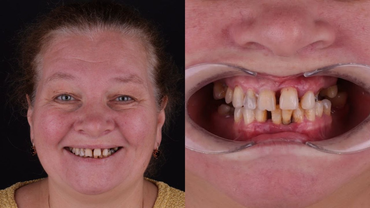 Фото нашей пациентки на момент обращения в клинику. 