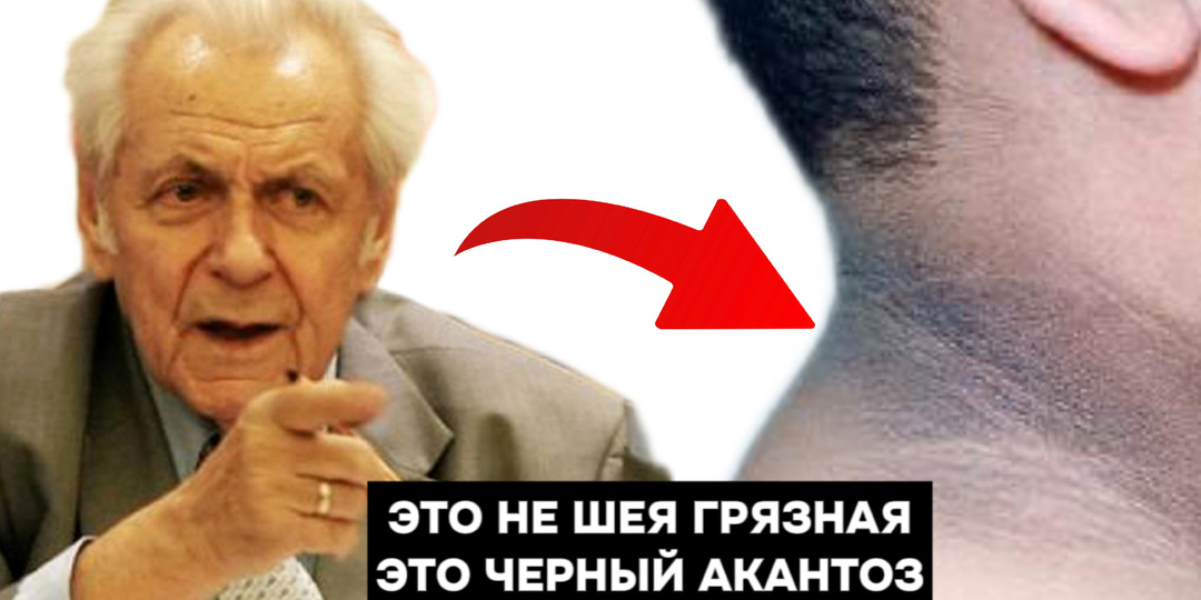 Ранние маркеры диабета: сигналы, которые тело посылает за год