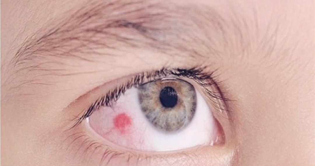 Изображение из Яндекс картинки 