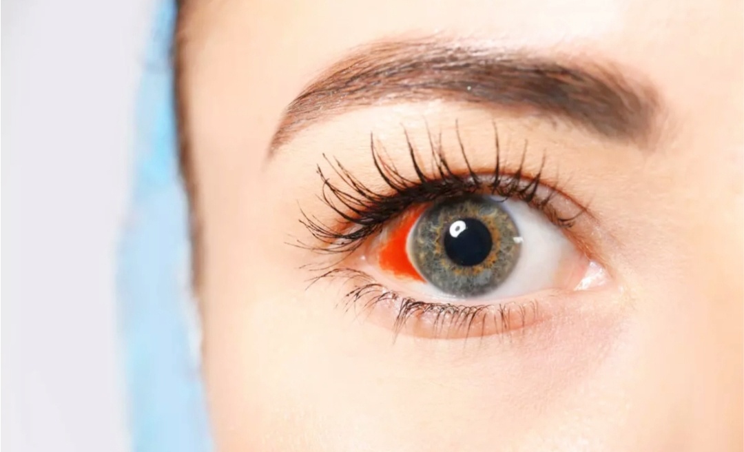 Изображение из Яндекс картинки 