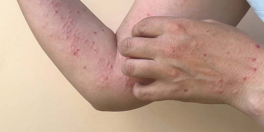    Фото: 123RF.com/irina3432