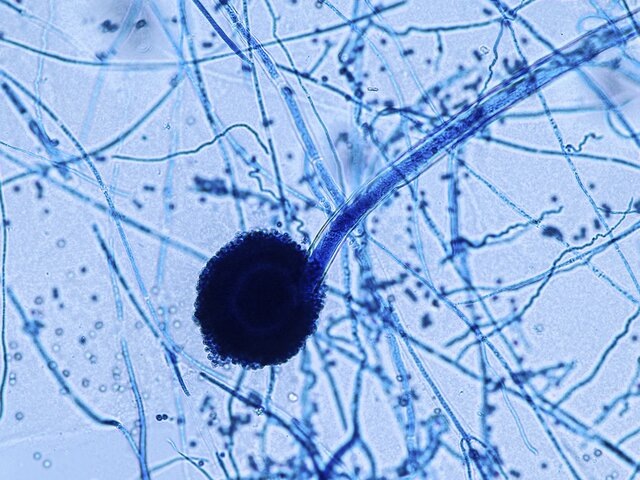 Врач Галлямова: контроль потребления мучного поможет избежать европейского "супергрибка"