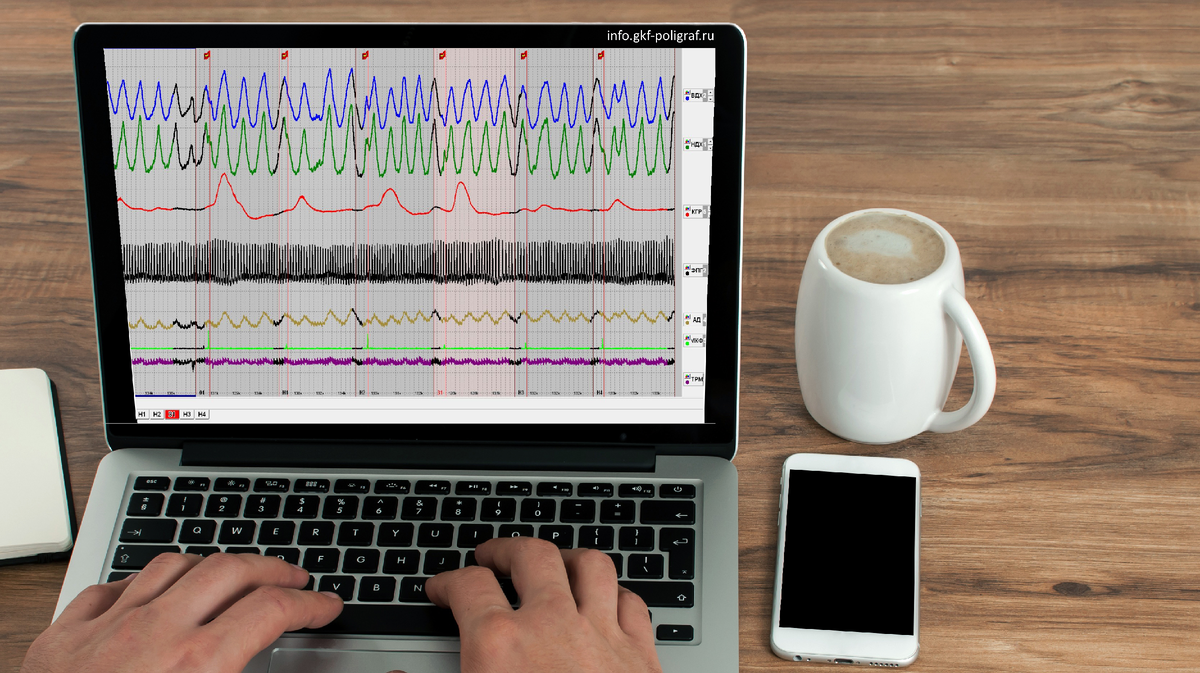 Так выглядят полиграммы - данные полученны с помощью полиграфа.