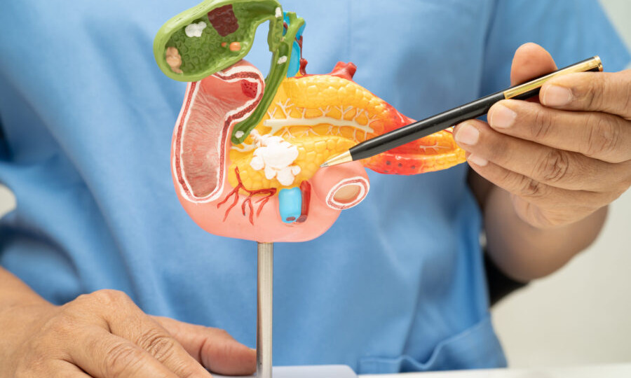 Что такое дискинезия желчевыводящих путей (ДЖВП)?