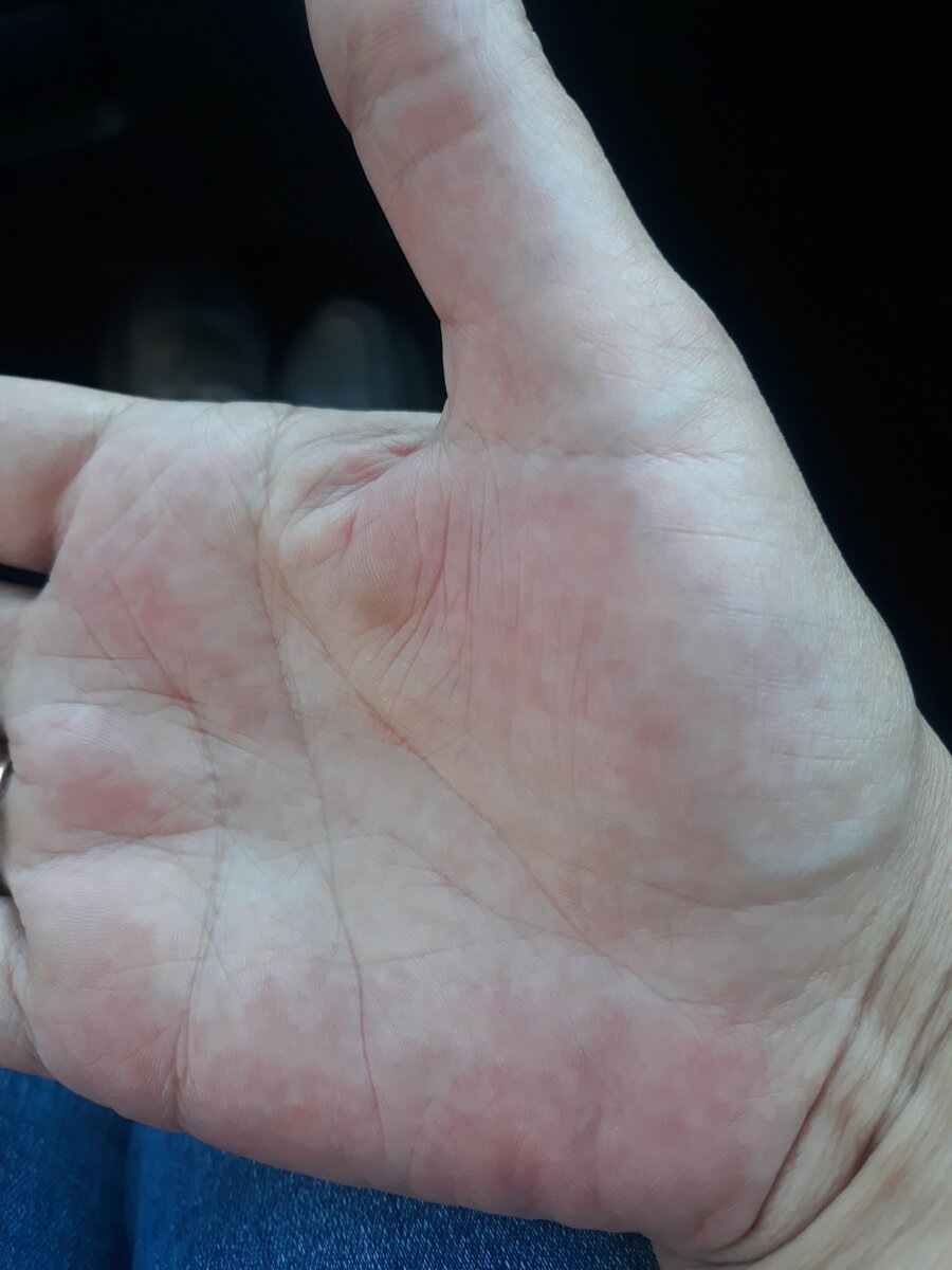 Фото руки женщины  с моего канала. 