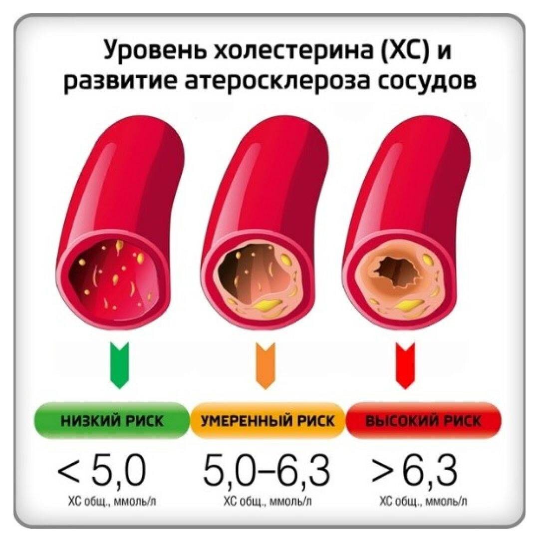 Уровень общего холестерина в крови