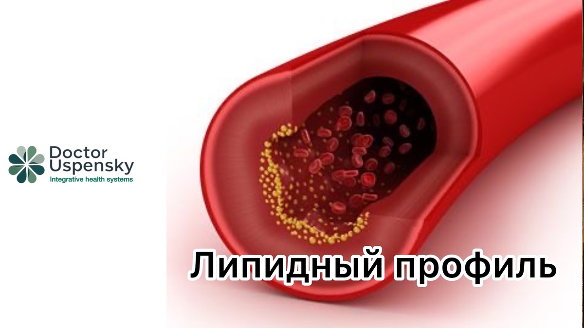 Холестерин в крови