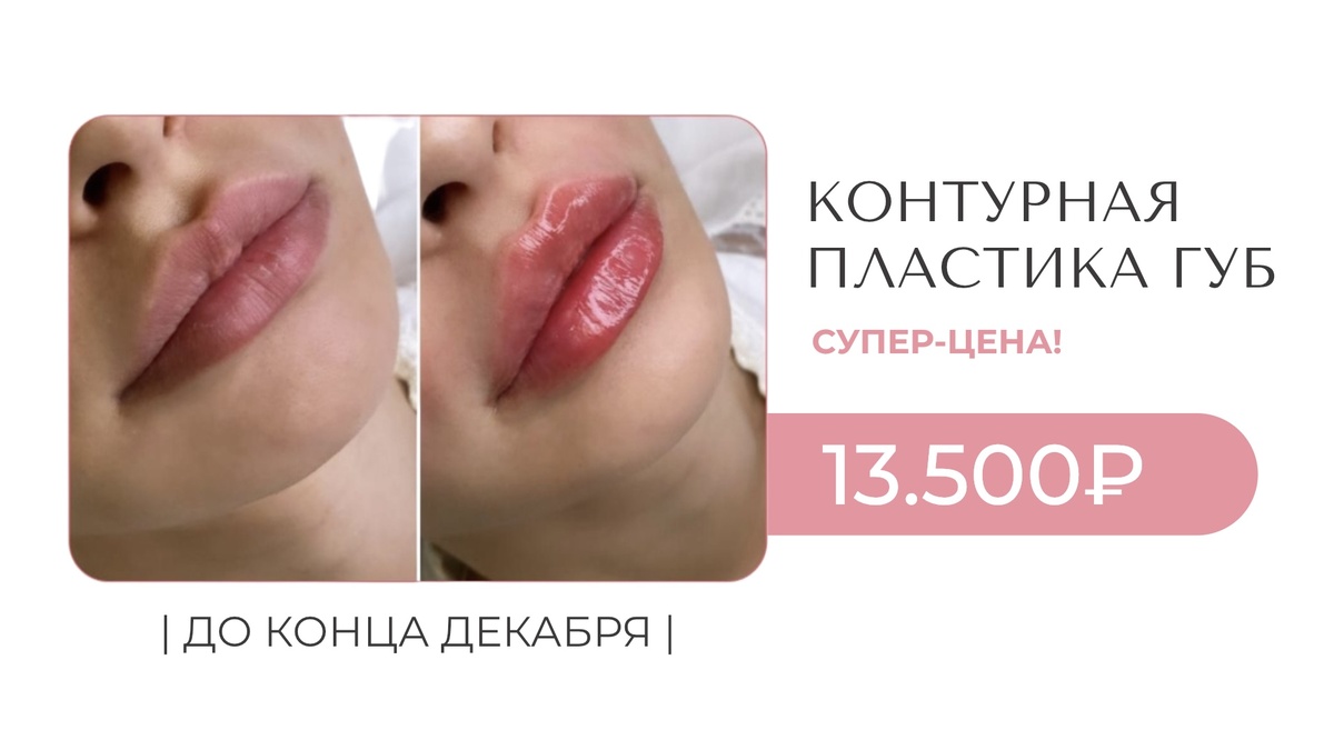 Результат на фото был достигнут в косметологии BALANCE в Москве 