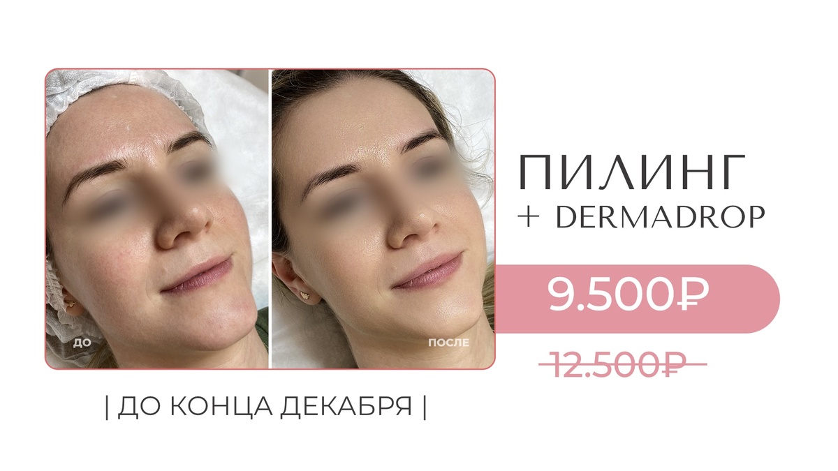 Результат был достигнут в косметологии Баланс в Москве 