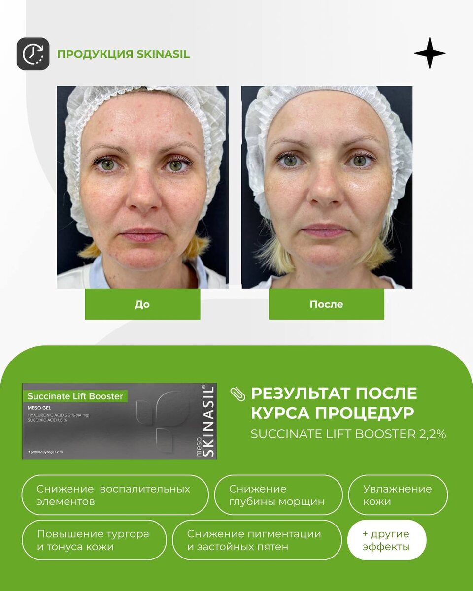 Кейс SKINASIL® SUCCINATE Lift Booster 2,2%