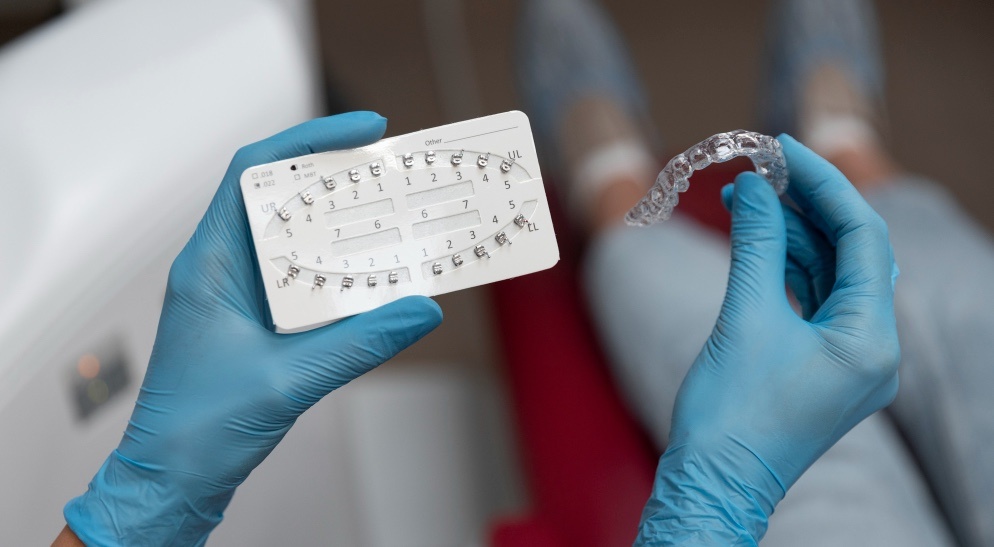 Элайнеры или брекеты: что выбрать деловому человеку в Екатеринбурге