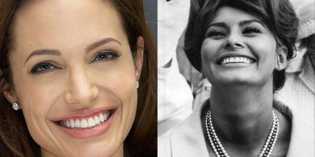 Улыбка на миллион (долларов и разбитых сердец!): Топ-20 самых ослепительных голливудских улыбок, от которых теряют дар речи...